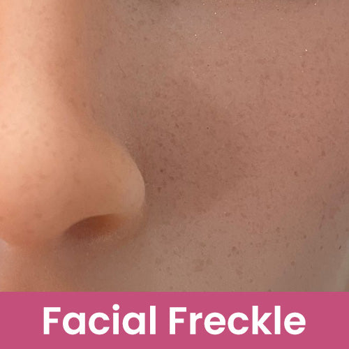 Funwest (Silicone) | Facial Freckle Upgrade (Not to Be Sold Without Sex Doll)